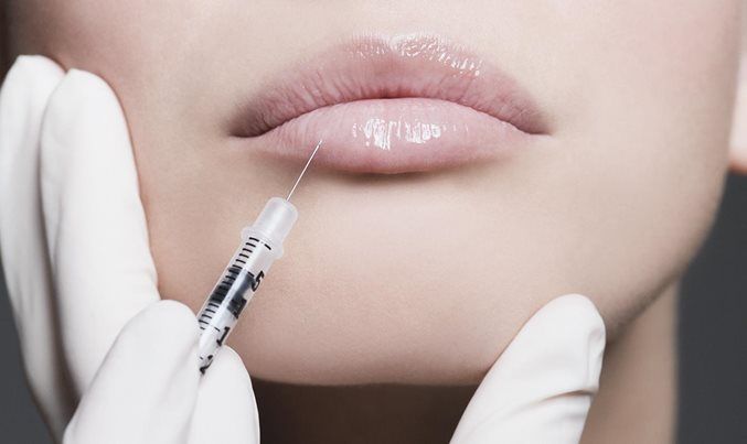 Does Lip Fillers Create a More Defined Smile Line?