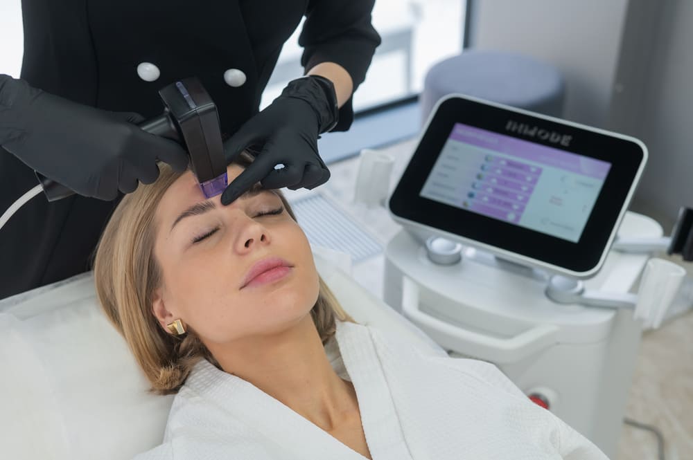 Can Morpheus8 Refine Uneven Facial Skin Texture Effectively?