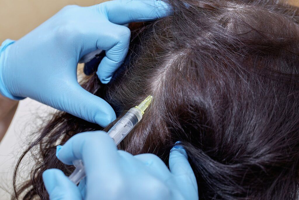 Can Female Hair Transplant Help Visible Scalp for Women?