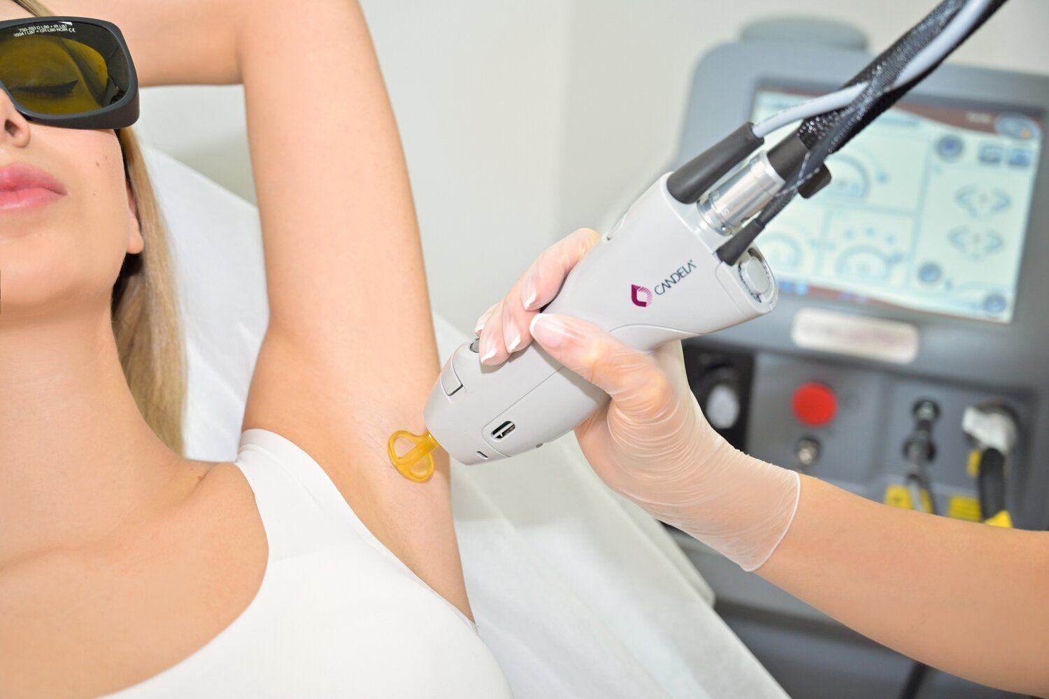Is Laser Hair Removal Helpful for People With Coarse Hair?